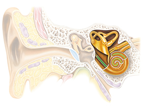 hearing_loss